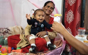 Help children like 1-year-old Mausam in Nepal receive life-changing surgery and rehabilitation for clubfoot.