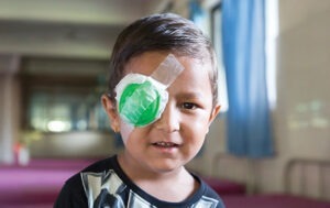 Help children like 5-year-old Krind in Nepal receive sight-saving cataract surgery.