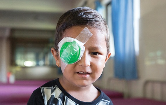 Help children like 5-year-old Krind in Nepal receive sight-saving cataract surgery.