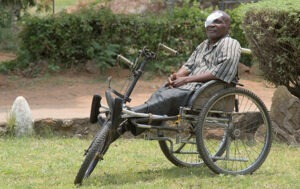 Rodgers received sight-saving cataract surgery at a cbm-funded hospital in Zimbabwe.