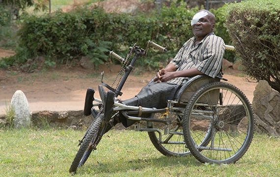 Rodgers received sight-saving cataract surgery at a cbm-funded hospital in Zimbabwe.