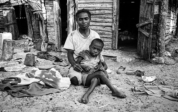 In Madagascar Mara & Maharavo, who has a disability, urgently need help due to the famine.