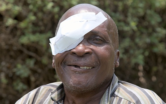Rodgers received sight-saving cataract surgery at a cbm-funded hospital in Zimbabwe.