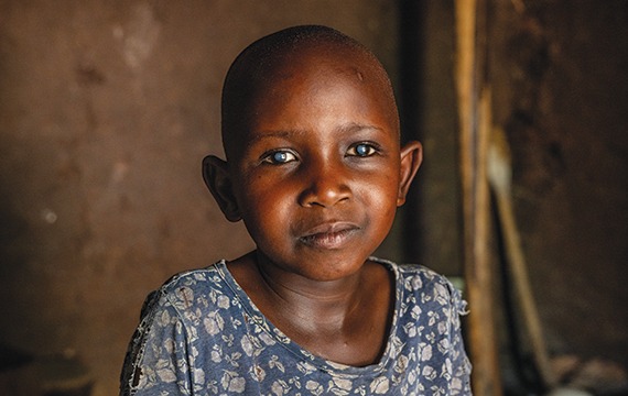 6-year-old Faith from rural Uganda is blinded by cloudy cataracts.